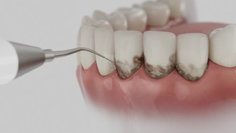 Reliable Dental Implants contractor in Penn Estates, PA by Smile Center Dentistry